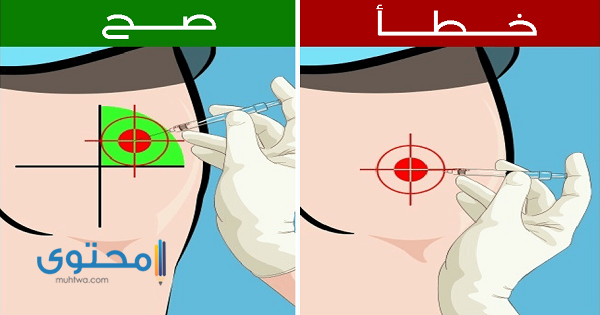 طريقة إعطاء حقن العضل