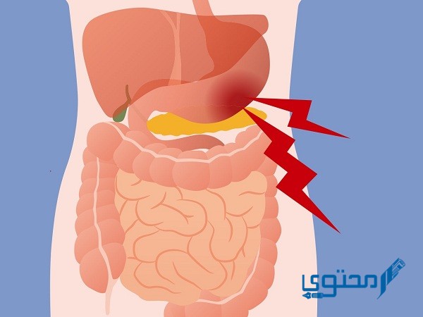 مكان القولون العصبي بالصور