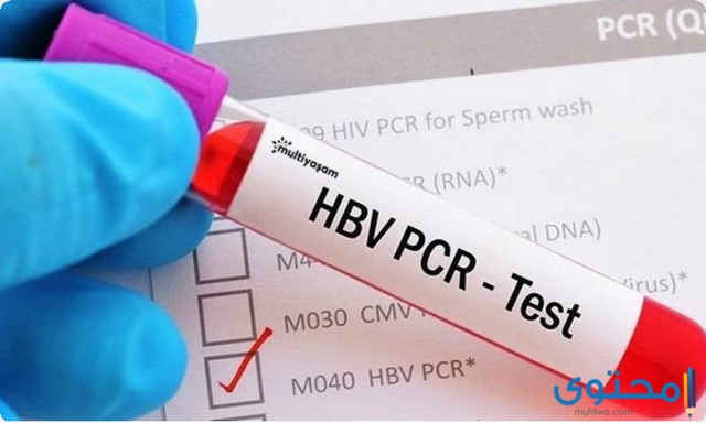 أسعار pcr فيروس كورونا في مصر للسفر