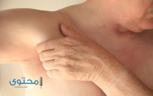 علاج وأسباب وجود ألم تحت الإبط الأيسر مع انتفاخ