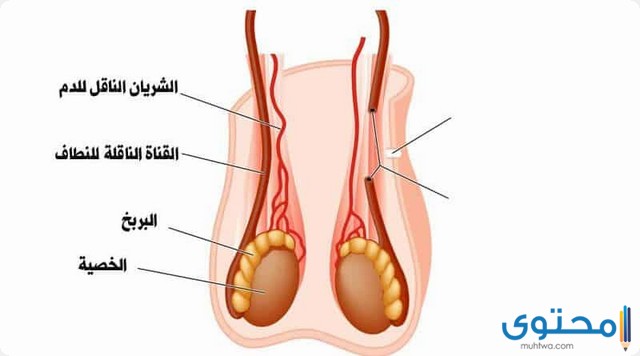 ألم في الخصية اليمنى