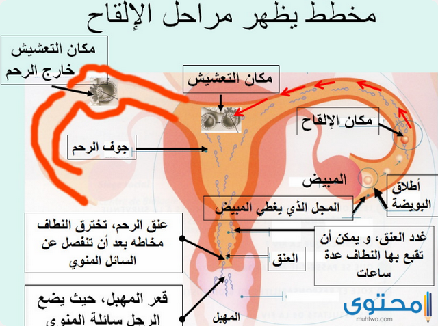 الإبرة التفجيرية 