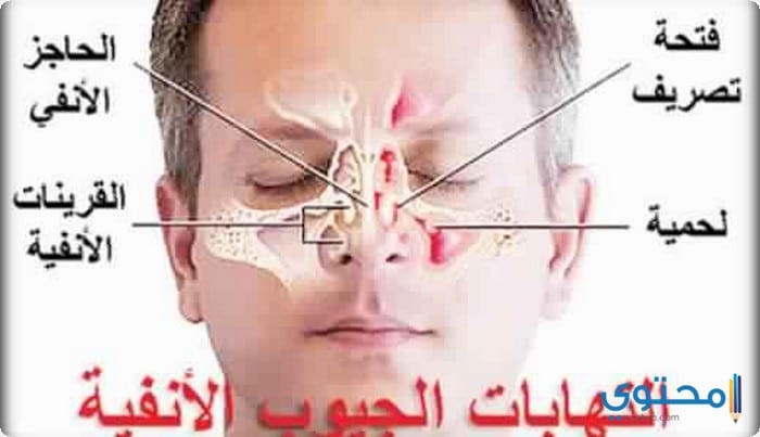 التهابات وحساسية الأنف