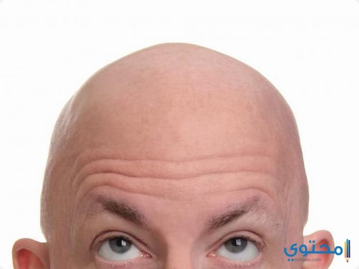 عيادات وأماكن زراعة الشعر في المغرب