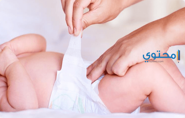 علاج تسلخات الأطفال بسبب الحفاضة