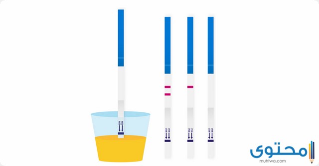 متى يظهر هرمون الحمل في البول