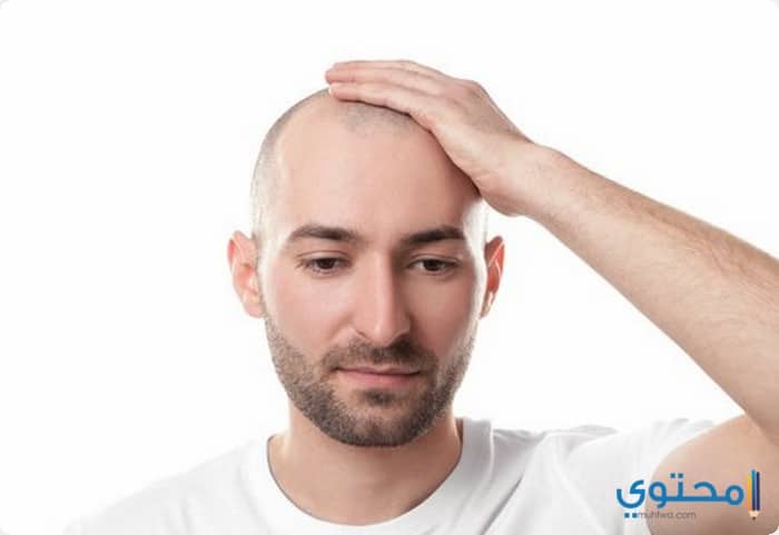 مراكز وتكلفة زراعة الشعر في الصين