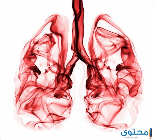 9 من أعراض التهاب الرئوي والأسباب وطرق العلاج