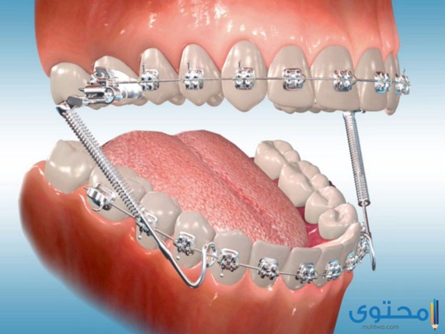 مستشفى أسنان في الإمارات